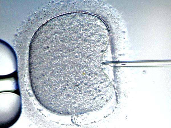 50,000 women undergo IVF treatment in Britain every year.  Rex Features  