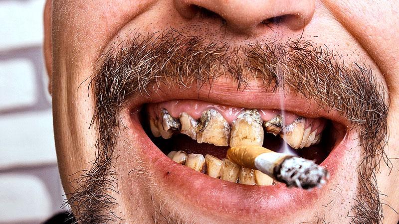 Smoking cigarettes is one of the leading causes of oral cancer