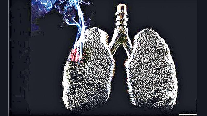 Smoking will cause the gradual corrosion of your lung tissues