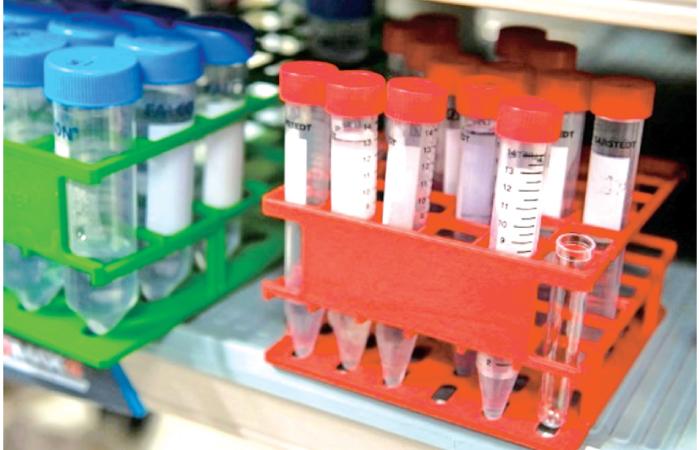 Urine samples are easier to administer than blood tests Pic: AFP/File