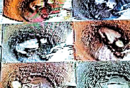 Photos of illegal digging from the Colombo Art Biennale