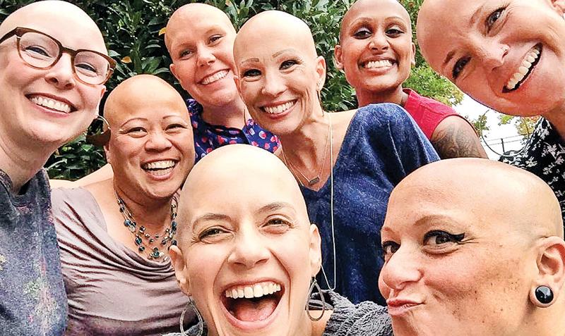 The bald truth Sunday Observer