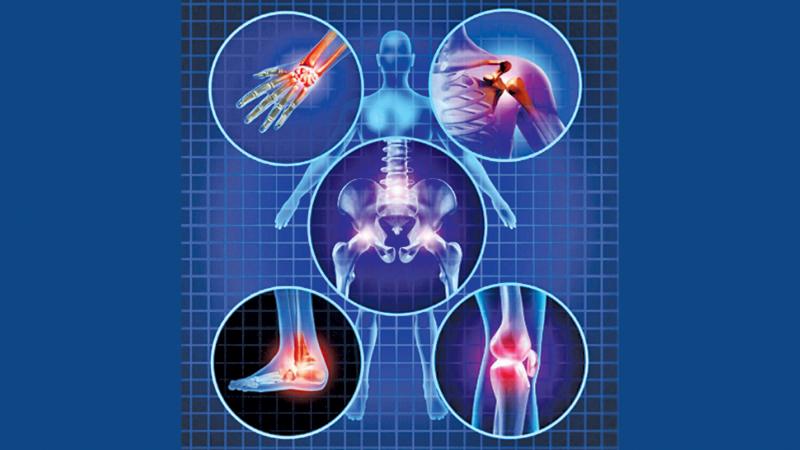 Healthy Joints Reduce Rheumatic And Musculoskeletal Disease Risks ...