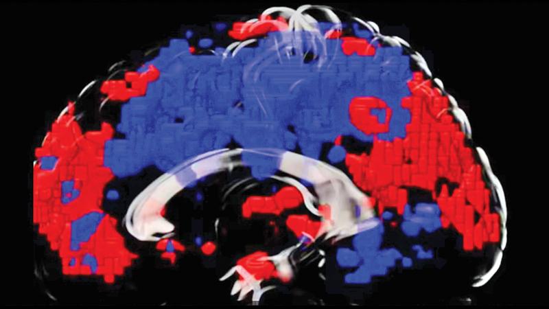 The fMRI image, taken from a volunteer asked to take a five-minute dip in 20C (68F) water, shows increased activity around the medial prefrontal cortex (right side, highlighted red) and parietal cortex (left side, highlighted red). These parts of the brain are involved in maintaining attention, helping decision-making and controlling emotions. The blue areas show a decrease in activity in other parts of the brain